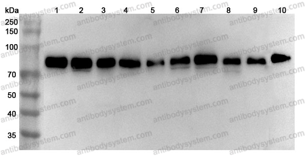 Anti-Human PRKCSH Polyclonal Antibody