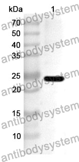 Anti-Human TRIM27 Polyclonal Antibody