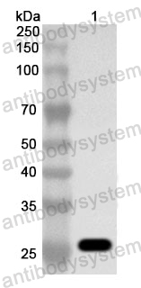 Anti-Human ATP1B2 Polyclonal Antibody