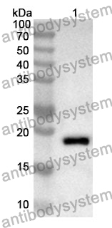 Anti-DRD2 Polyclonal Antibody