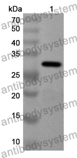 Anti-NID1 Polyclonal Antibody