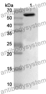 Anti-PKM Polyclonal Antibody