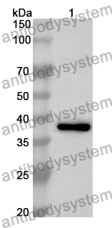 Anti-ACYP2 Polyclonal Antibody