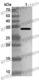 Anti-HSP90B1 Polyclonal Antibody