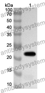 Anti-MYL6B Polyclonal Antibody