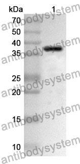 Anti-CD121a/IL1R1 Polyclonal Antibody