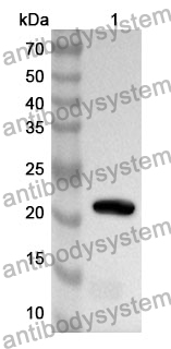 Anti-MMP9 Polyclonal Antibody