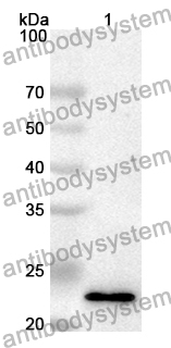 Anti-Human COX6B1 Polyclonal Antibody