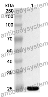 Anti-Human HNRNPL Polyclonal Antibody