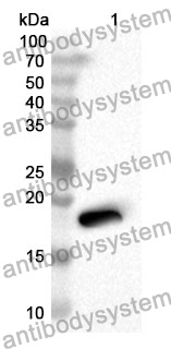 Anti-DARS1 Polyclonal Antibody