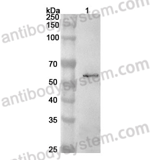 Anti-Human ETS1 Polyclonal Antibody