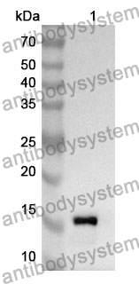 Anti-UQCRB Polyclonal Antibody