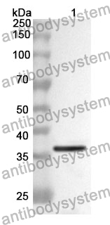 Anti-CPB1 Polyclonal Antibody