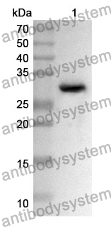 Anti-CD119/IFNGR1 Polyclonal Antibody