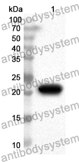 Anti-ACP3 Polyclonal Antibody