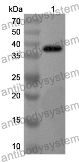 Anti-EZR Polyclonal Antibody