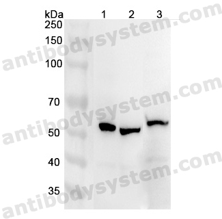 Anti-Human ATP6V1B1 Polyclonal Antibody