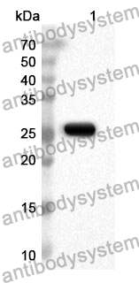 Anti-Human FOLR1 Polyclonal Antibody