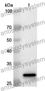 Anti-Human UCHL3 Polyclonal Antibody