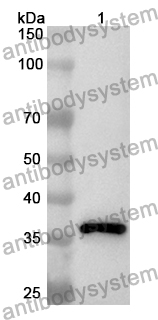 Anti-Human FOSL2 Polyclonal Antibody