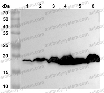 Anti-Human NME1 Polyclonal Antibody