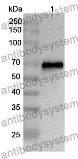 Anti-CYP11B1 Polyclonal Antibody