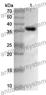 Anti-Human TCF4 Polyclonal Antibody