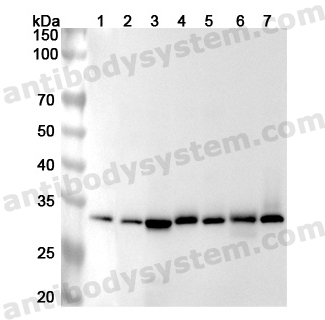 Anti-Human RPA2 Polyclonal Antibody