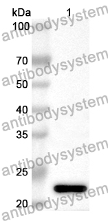 Anti-Human GATA1 Polyclonal Antibody