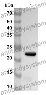 Anti-Human TIMP2 Polyclonal Antibody