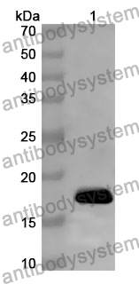 Anti-ALOX15 Polyclonal Antibody