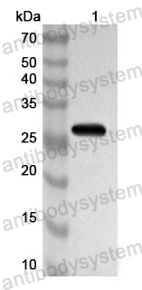 Anti-ACAN Polyclonal Antibody