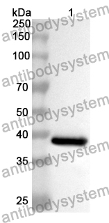 Anti-CD104/ITGB4 Polyclonal Antibody