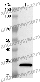 Anti-CBR1 Polyclonal Antibody