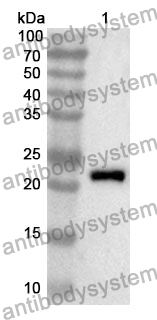 Anti-ACADS Polyclonal Antibody