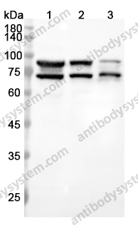 Anti-POR Polyclonal Antibody