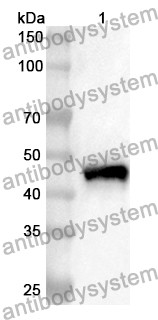 Anti-Human DPEP1 Polyclonal Antibody