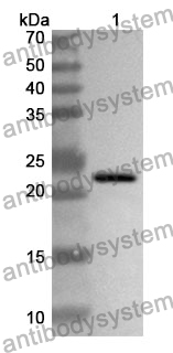 Anti-MGMT Polyclonal Antibody