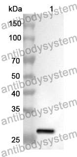 Anti-PRLR Polyclonal Antibody