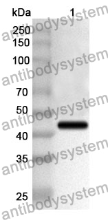 Anti-CD62E/SELE Polyclonal Antibody