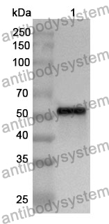 Anti-ATP2A2 Polyclonal Antibody