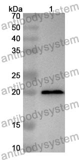 Anti-Human CCL3L1 Polyclonal Antibody