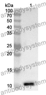 Anti-NPPB Polyclonal Antibody