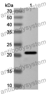 Anti-CPE Polyclonal Antibody