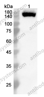 Anti-PLCG2 Polyclonal Antibody