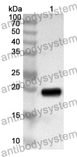 Anti-FAH Polyclonal Antibody