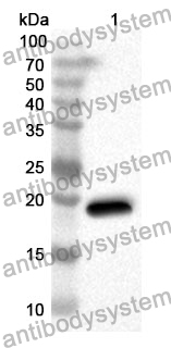 Anti-STMN1 Polyclonal Antibody