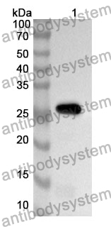 Anti-IFNAR1 Polyclonal Antibody