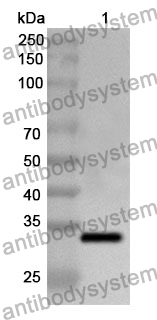 Anti-SMPD1 Polyclonal Antibody