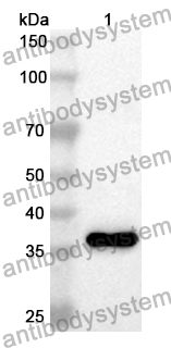 Anti-Human UBTF Polyclonal Antibody